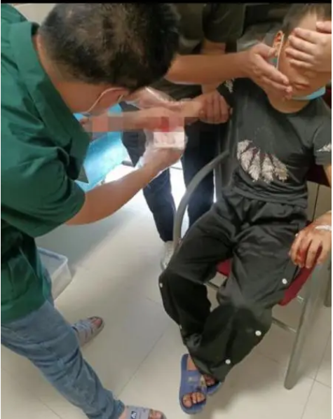 重庆野猴4个月伤害近10人至今未抓获，曾险些拖走3岁女童