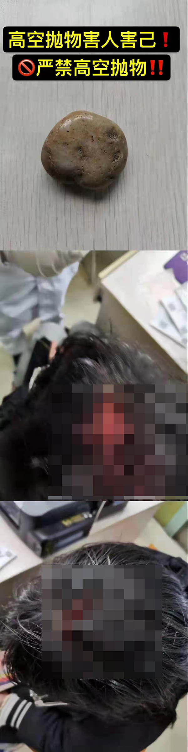成都一名7岁儿童从12楼投掷鹅卵石 致一