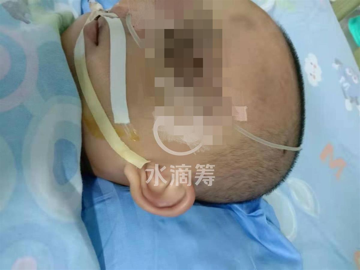 湖南一对幼童兄弟遭继祖父殴打，2岁弟弟颅